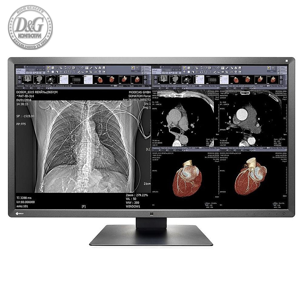 Медицински монитор EIZO RadiForce MX315W 8MP Цветен